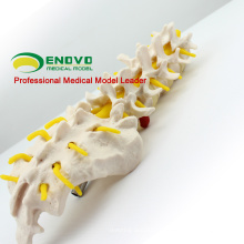 VERTEBRA01 (12384) Life-size Human Lumbar Vertebrae with Sacrum, Lumbar Spinal Column Model for Medical Science